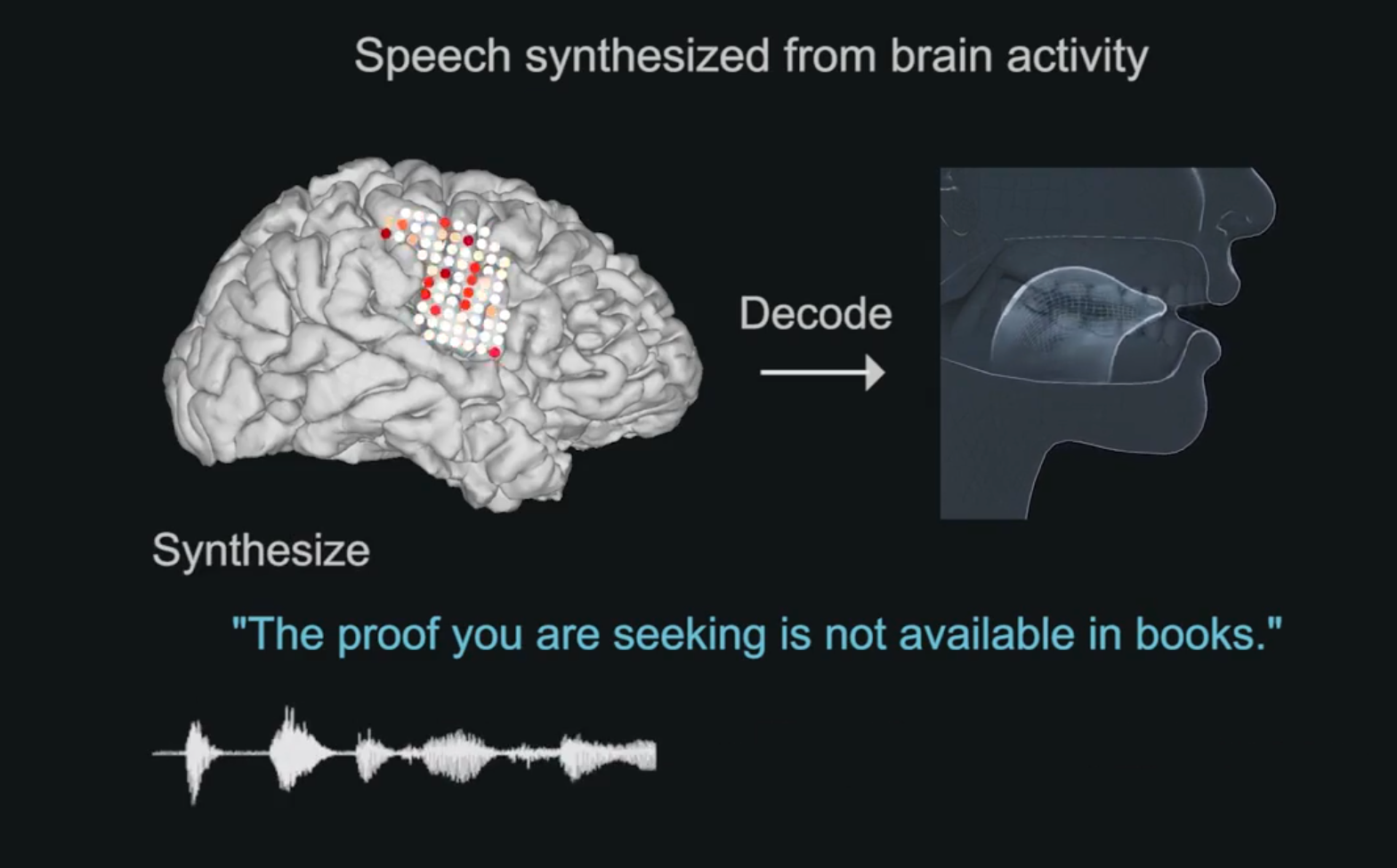 Voice Using Brain Creating Speech From Brain Signals – RJ's Corner – Having My Say